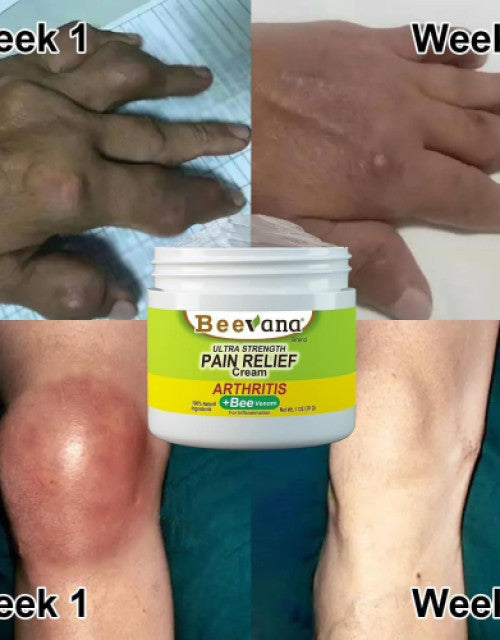 Bee Venom Joint and Bone Therapy Cream