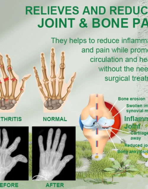 Bee Venom Joint and Bone Therapy Cream