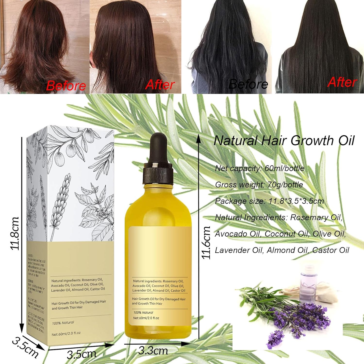 🤩Veganic Natural Hair Growth Oil 30ml [Buy 1 Get 1 free]🤩